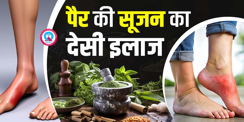 पैर-की-सूजन-का-देसी-इलाज